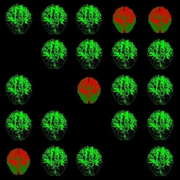 A Roma la mostra Contagion